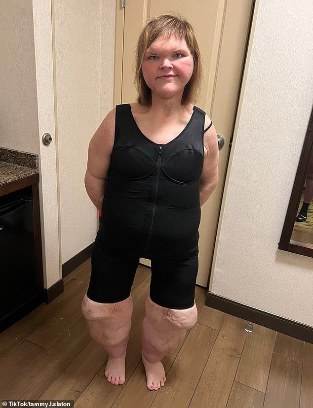 美國(guó)“千斤姐妹”已暴瘦